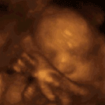 3 D live Fetus/Baby